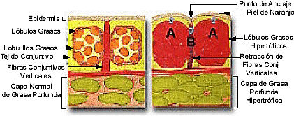 COMPARACIN DE CONDICIONES NORMAL E HIPERTROFICA